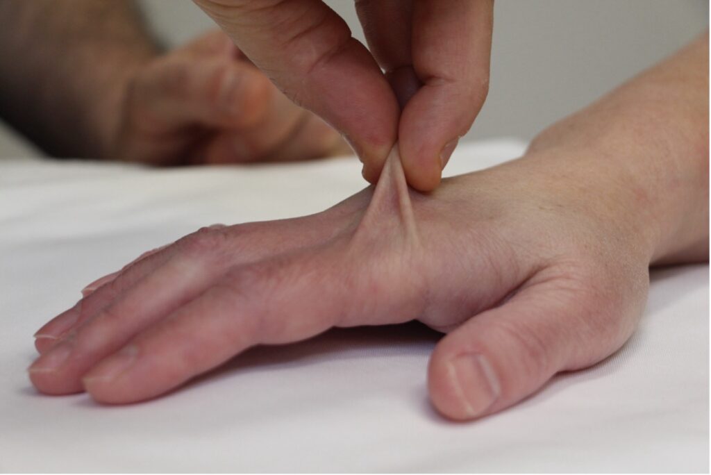 Drainage Lymphatique manuel avancé